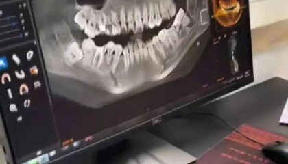 女子疑因被拔错牙坠楼后续：家属与相关方已达成协商