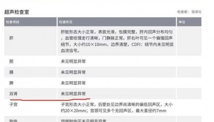 女律师在爱康国宾体检10年未提示癌症，在国外确诊，爱康国宾回应：公司正在讨论处理